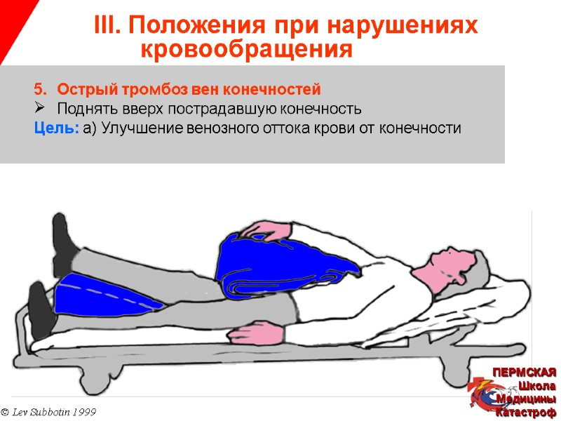 III. Положения при нарушениях   кровообращения © Lev Subbotin 1999